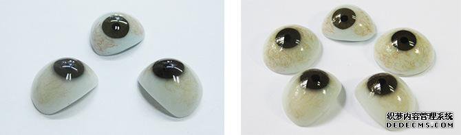 角膜白斑病人的義眼配戴的優(yōu)點(diǎn)